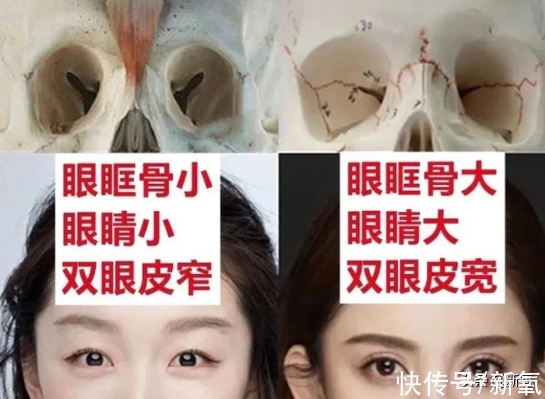 眼位|姐妹，双眼皮再好，咱也别硬割啊