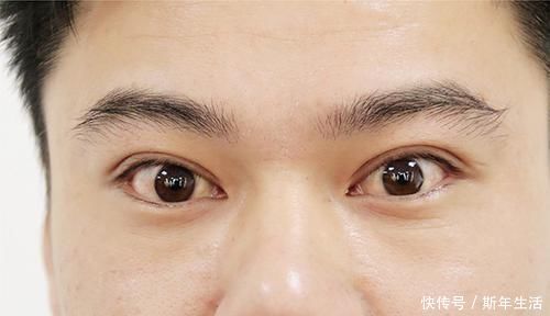 迹象|肿瘤医生:身体频繁有3个迹象,或是甲状腺癌“一级预警”