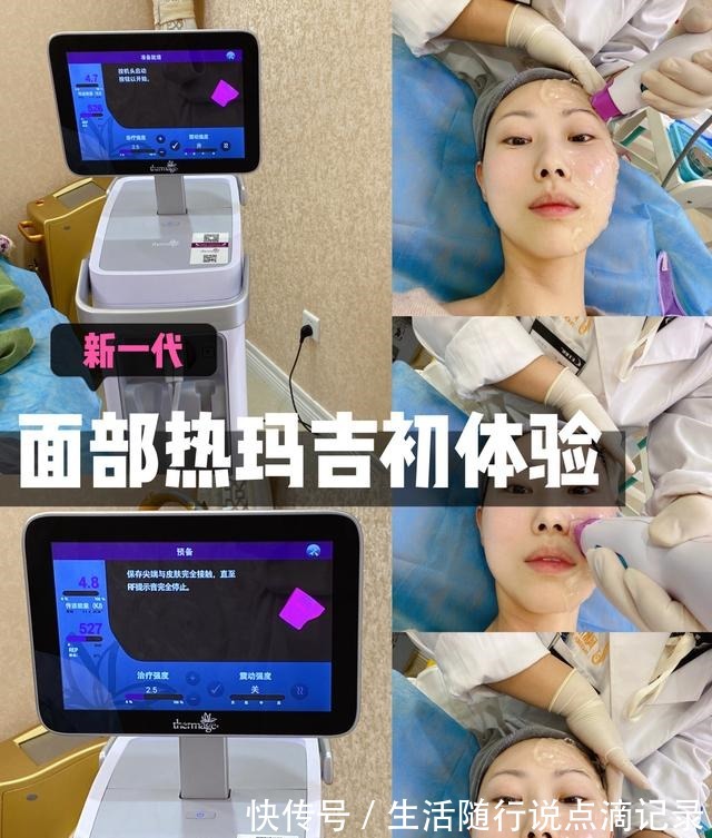 面部 对抗地心引力一直在路上丨面部热玛吉初体验!