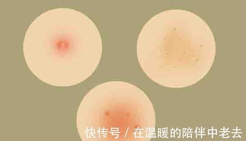 碱性食物|女性不想老得快,常吃碱性食物,美容养颜,皮肤更水灵,50不显老