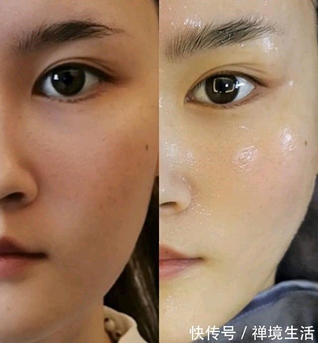 调皮 又去做光子嫩肤啦!真的是会上瘾!又去做光子嫩肤啦!真的是会上瘾!