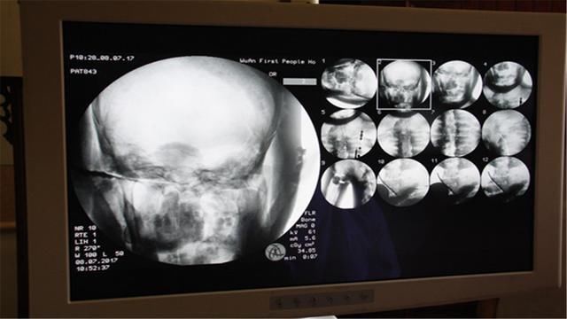至今|千年前河北一高僧坐化,遗体至今不腐,专家用X光扫描后得出结论