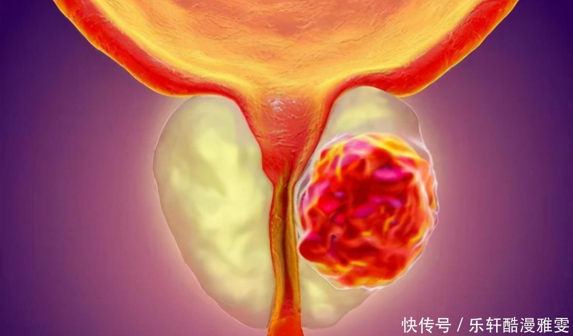 山药|吃生蚝对前列腺好医生真正对前列腺好的5种食物，照着吃不会错