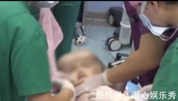 治疗|3岁女童头重达20斤,手术刚要进行,家人却放弃治疗准备寿衣