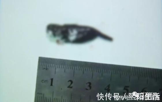 生水|女子喉咙中取出5厘米长的蚂蟥，这个习惯很多人都有