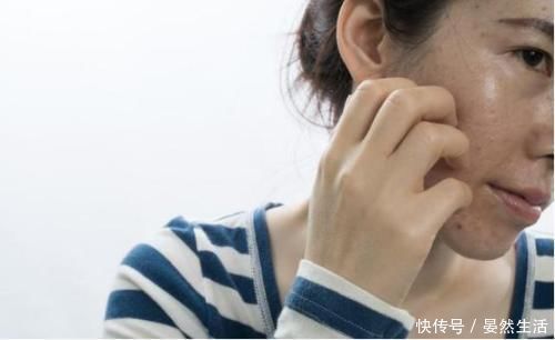 去角质|让皮肤变差的3种护肤方式,真的,你还不如只用清水洗脸