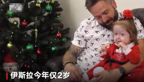全球首例！2岁女童却有80岁的脸，网友：希望能像本杰明巴顿一样