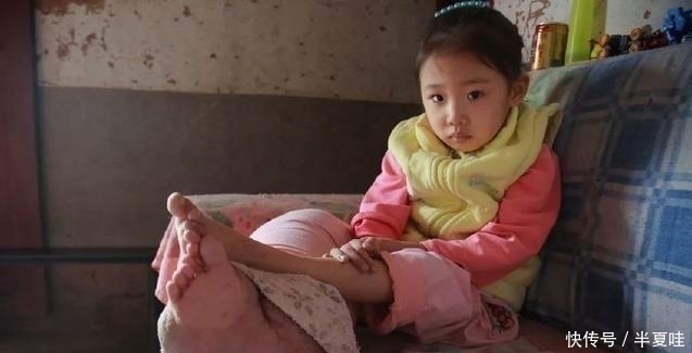 治病|5岁女孩因没钱治病,拖着象腿一样粗的大腿,每天吃止痛片止痛