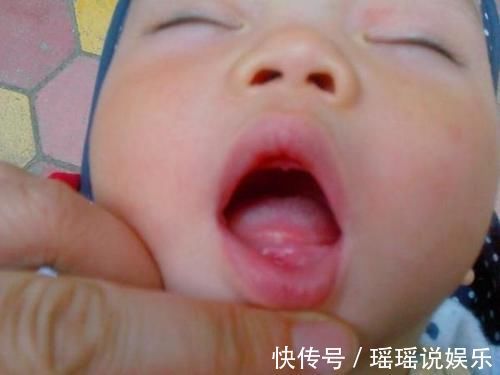 橡皮泥|8岁男童停止发育,医生:吃一次等于吃10块橡皮泥,家长傻乎乎喂