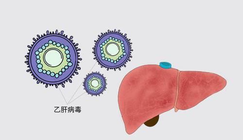  人群|乙肝人群，不想肝硬化，医生支给你4条建议，平时要落实到位