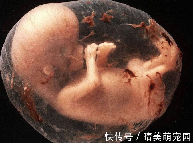 羊水|胎儿在母亲肚子里,生活的很“精致”,那他的大小便都去哪了?
