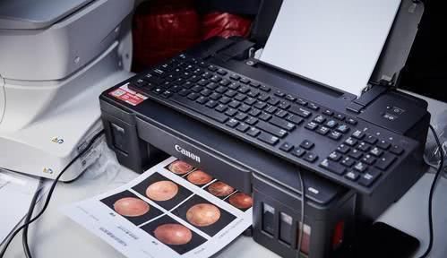 糖尿病人|糖尿病人注意:每年做好这3项检查不偷懒,帮你预防糖尿病并发症