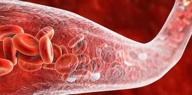 血管疾病|它是甘油三酯的“死对头”，放肆喝，稀释血液，血管一通到底