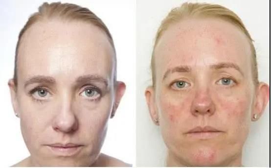 一个月|坚持一个月不洗脸,人的容貌会有什么变化?看这些对比图你就懂了