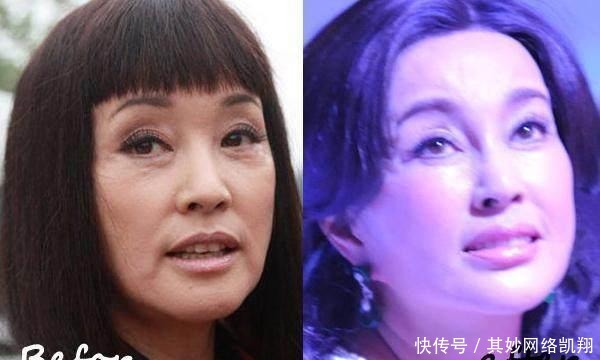 垮掉|明星都爱打玻尿酸, 但你一定没看过她们脸垮掉的样子