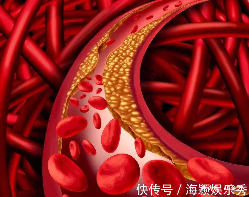 脱发|通毛孔、通血管、通七窍，这个清代的中医方子，排尽全身上下淤血