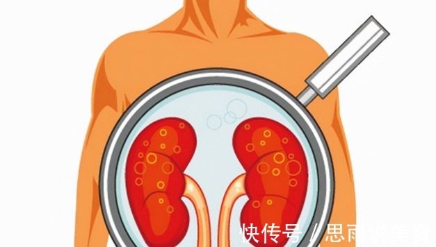 降糖药|糖尿病天天吃二甲双胍,请花几分钟时间搞清这5个问题,很重要