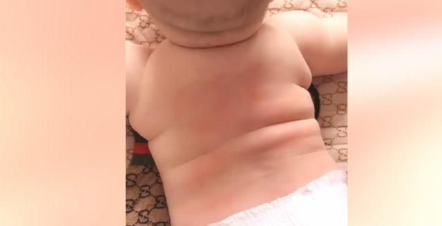 妈妈|妈妈用吃果冻的杯子,给萌娃拔火罐,网友宝宝很享受的样子