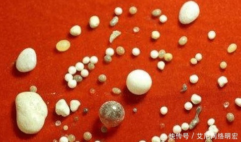 舍利子|舍利子是什么?高僧火化的时候才有,普通人为何没有呢?