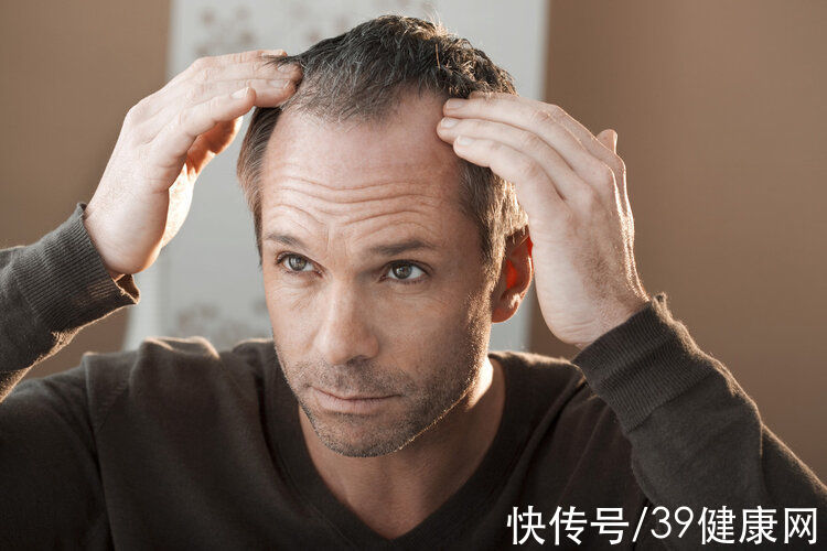 毛囊|年纪轻轻就脱发?5大恶习是脱发的“催化剂”,医生分享治疗方案