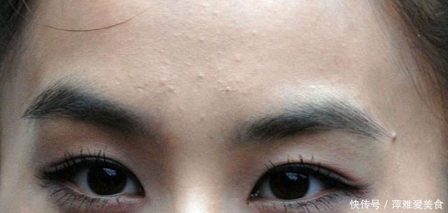 如果戒冷、戒糖、戒辣的话，皮肤会变好吗？