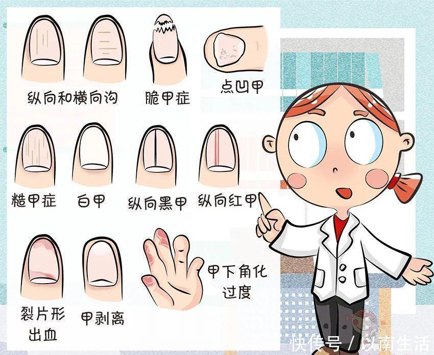 爸妈|倒刺、白斑,这还是宝宝的小指甲吗?要紧吗?宝宝指甲问题大汇总