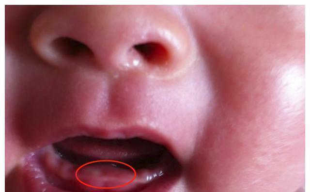 乳牙|宝宝几个月长牙正常？这份宝宝“乳牙萌发和护理表”，请家长收下