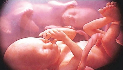 妈妈带|孕妇顺产双胞胎后大喊:肚子还在动,医生检查发现惊喜