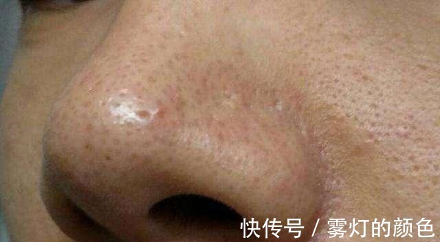 药店|药店有一种乳膏, 皮肤越擦越白, 全是胶原蛋白, 可惜知道的人稀少!