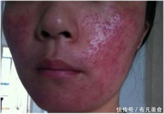 这些医美项目比你们所有的化妆品还有用!