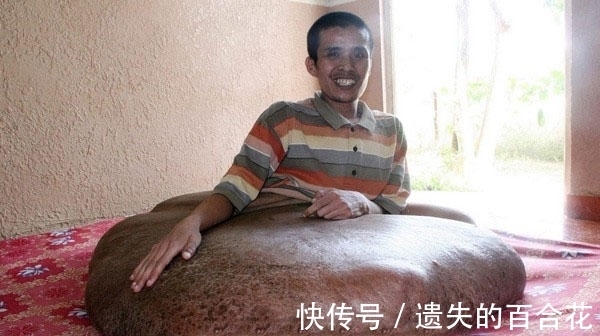 男子|男子的腿长成了一块“大岩石”，天天坐在上面，画面让人害怕