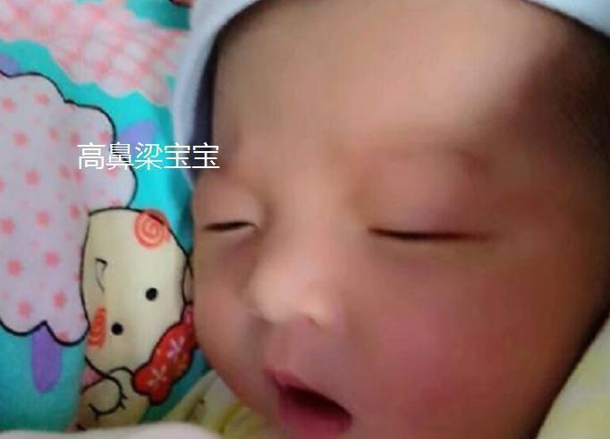 宝宝|宝宝的鼻梁何时“定型”?塌鼻梁的娃想“逆袭”,要满足哪些条件