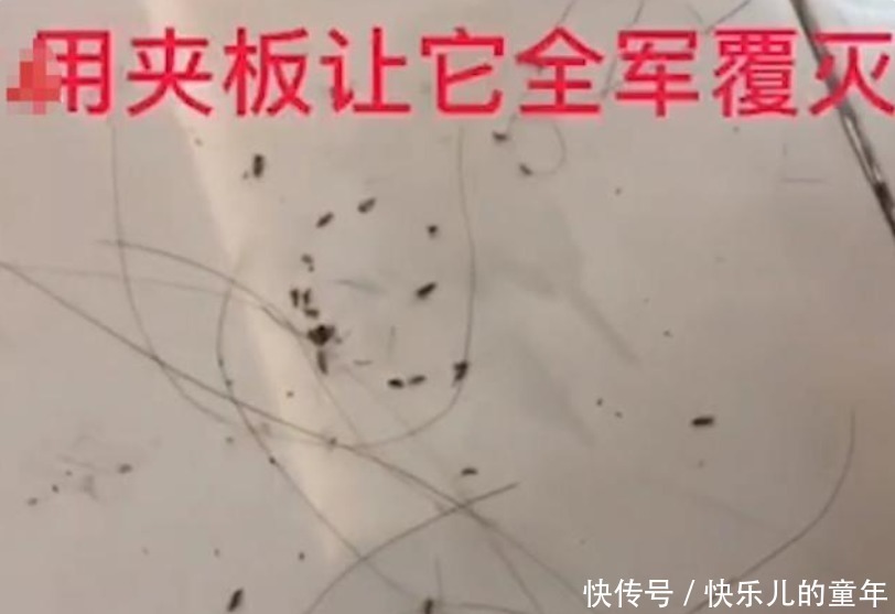 夹板|女儿被同学染上头虱,妈妈用热夹板一夹,下一幕引起舒适