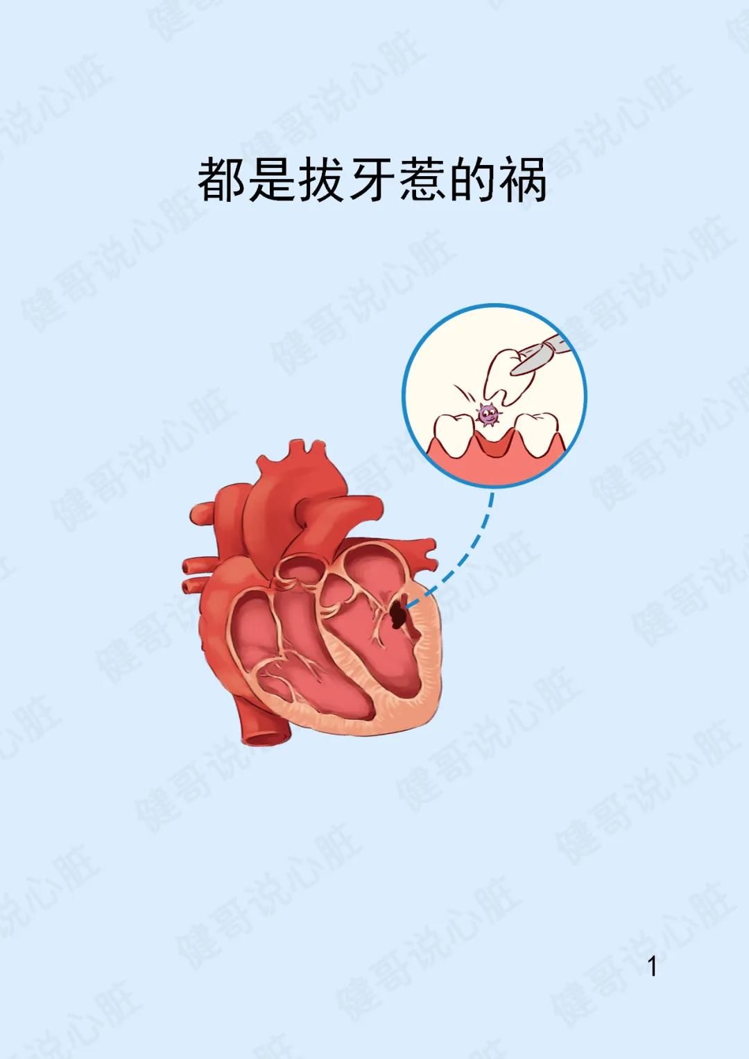 心脏|【健哥说心脏】都是拔牙惹的祸