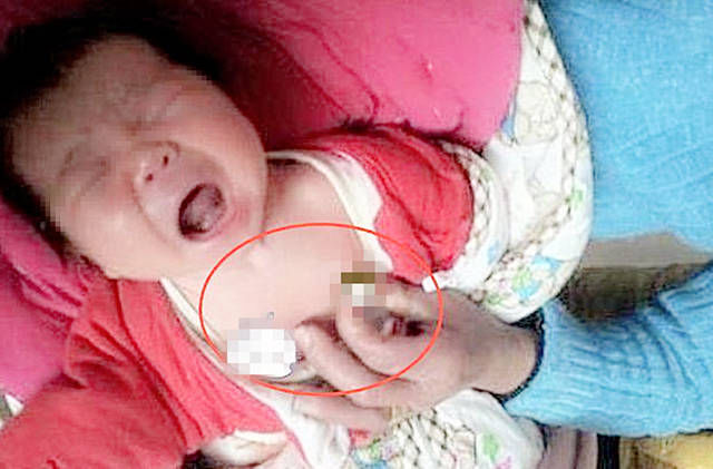 王女士|新生儿患上败血症,只因妈妈这个小动作,网友怎么狠心下得了手