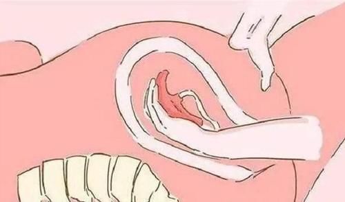 产妇|都说生孩子疼,其实产后这三件事比生孩子还要疼!你经历过几个?