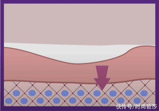 那些脸上没瑕疵的人，都在“酸”些什么？