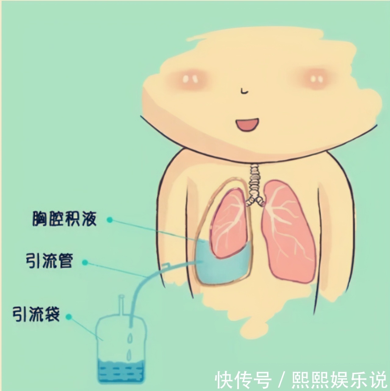 复发|看中医效果显著而忽视病情,发现肿瘤已是晚期,治疗后复发咋办