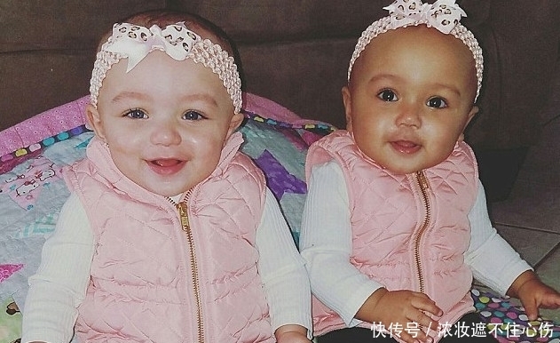 卵双胞|小夫妻生了双胞胎，竟发现是黑白两种颜色，结果让人开心不已！