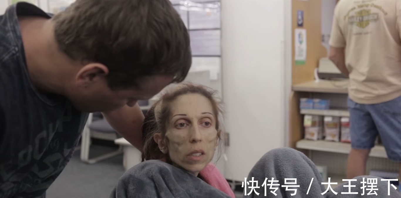 丈夫|妻子瘦到只有30斤,丈夫每天强迫她吃肉,如今发生翻天覆地的变化