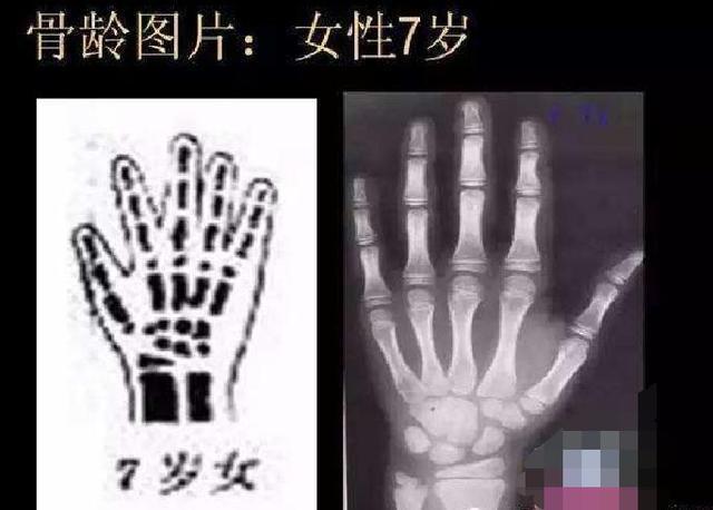 朋友说|孩子三个地方“短”,基本与高个子拜拜,家长别拔苗助长