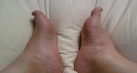 留心|孕期水肿发生前，身上这些信号可以察觉，孕妈最好多留心眼