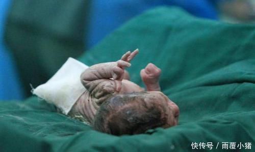 急产|孕妇刚躺上产床,孩子就“呱唧”一声出来了,医生皱眉不是好事