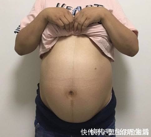 足月|胎儿已经足月，却检查发育不成熟，准妈妈多留心眼