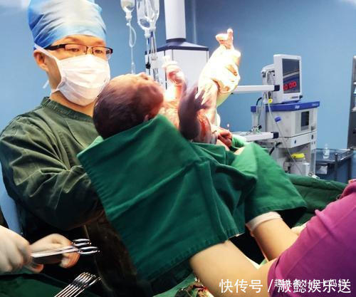 分娩|27岁产妈生下龙凤胎,医生准备缝合时,宝妈突然高喊“等一下”