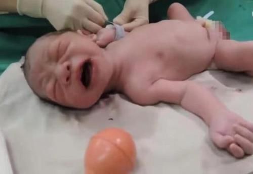 分娩|一组图带你了解:宝宝出生后,被医生抱走的神秘十分钟都经历了啥