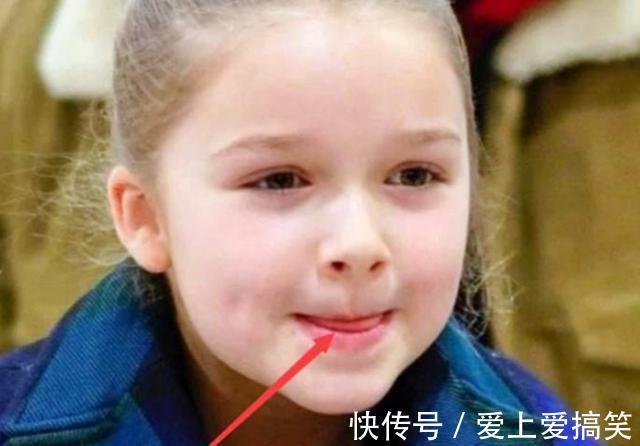 护理|孩子嘴唇干裂、起皮还出血怎么办？医生教你正确护理，比喝水管用