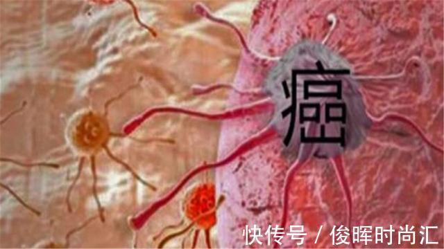 恩维达|喜讯传出!新型抗癌药上线,30分钟完成治疗,定价非常喜人