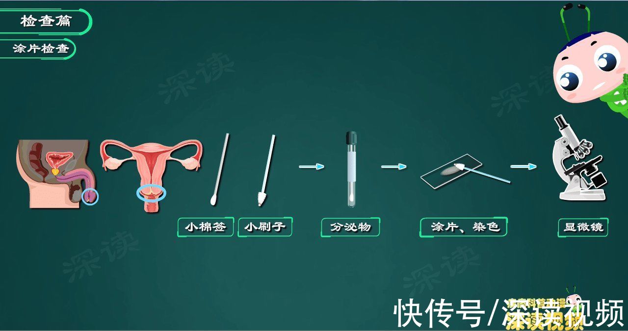 抗生素|得了淋病遭罪不说,还易复发,该咋办?快看看你的药都用对了吗?