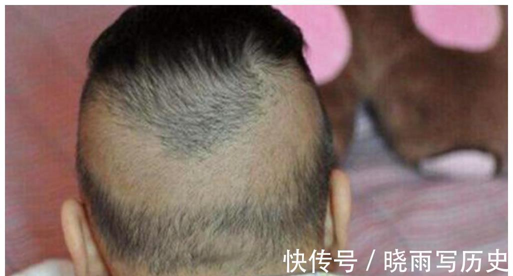 宝宝|孩子头发又黄又少,还枕秃是缺钙?剃光后头发能变好?家长必读